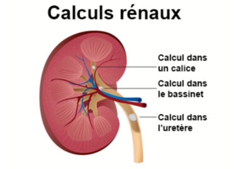 urinaire